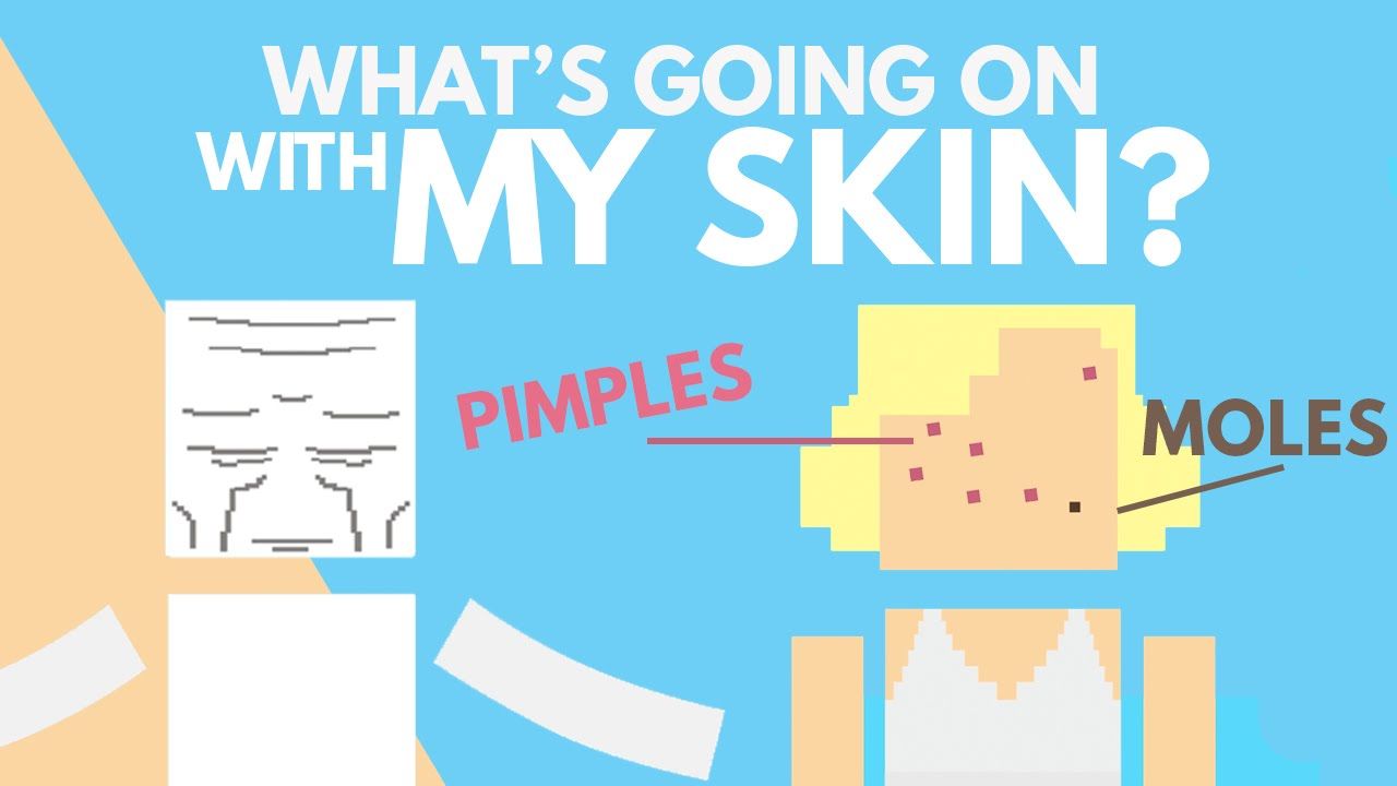 The Science of Pimples, Wrinkles and Moles!